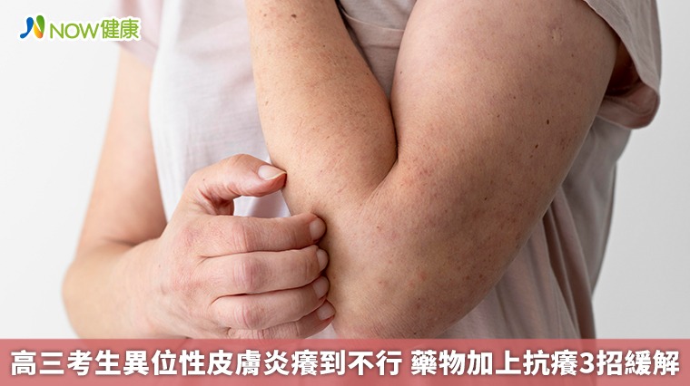 高三考生異位性皮膚炎癢到不行 藥物加上抗癢3招緩解 高三考生異位性皮膚炎癢到不行 藥物加上抗癢3招緩解