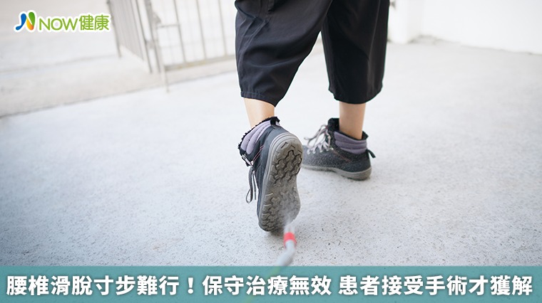腰椎滑脫寸步難行!保守治療無效 患者接受手術才獲解 腰椎滑脫寸步難行!保守治療無效 患者接受手術才獲解