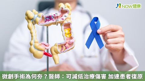 大腸癌常見致病原因公開！ 醫直言及早做1動作可預防