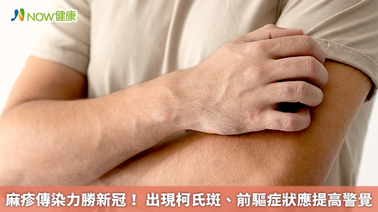 麻疹傳染力勝新冠! 出現柯氏斑、前驅症狀應提高警覺 麻疹傳染力勝新冠! 出現柯氏斑、前驅症狀應提高警覺