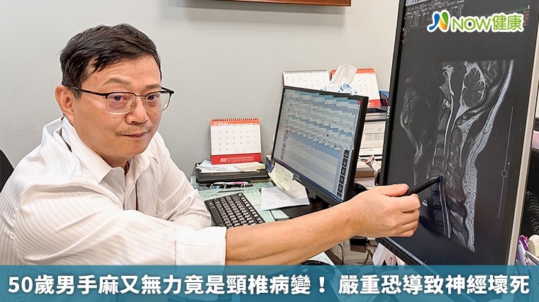 50歲男手麻又無力竟是頸椎病變! 嚴重恐導致神經壞死 50歲男手麻又無力竟是頸椎病變! 嚴重恐導致神經壞死