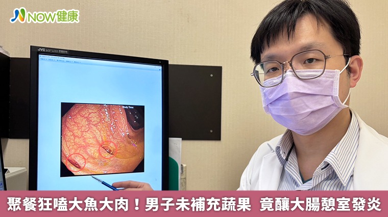 聚餐狂嗑大魚大肉!男子未補充蔬果 竟釀大腸憩室發炎 聚餐狂嗑大魚大肉!男子未補充蔬果 竟釀大腸憩室發炎