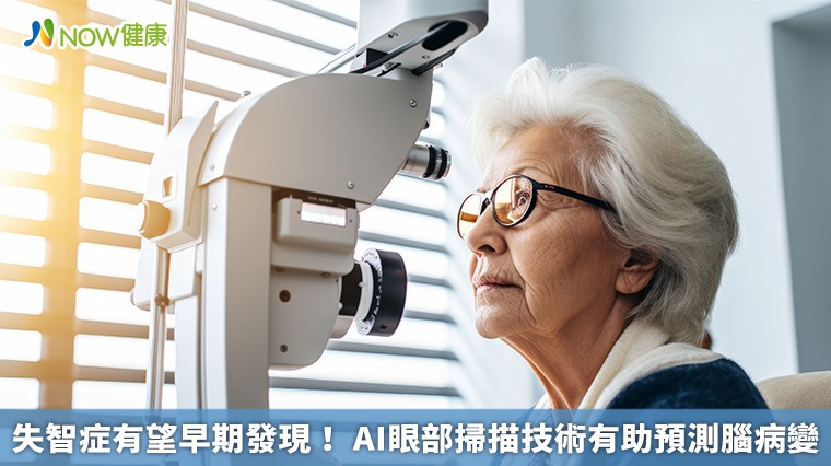 失智症有望早期發現! AI眼部掃描技術有助預測腦病變 失智症有望早期發現! AI眼部掃描技術有助預測腦病變