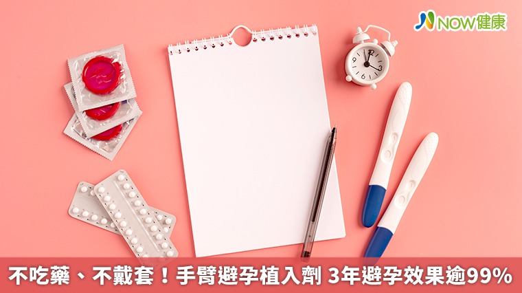 不吃藥、不用避孕器!女性採手臂植入劑 避孕無煩惱 不吃藥、不用避孕器!女性採手臂植入劑 避孕無煩惱