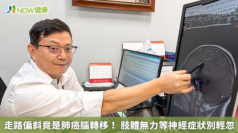 走路偏斜竟是肺癌腦轉移! 肢體無力等神經症狀別輕忽 走路偏斜竟是肺癌腦轉移! 肢體無力等神經症狀別輕忽