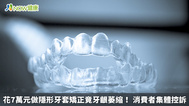花7萬元做隱形牙套矯正竟牙齦萎縮! 消費者集體控訴 花7萬元做隱形牙套矯正竟牙齦萎縮! 消費者集體控訴