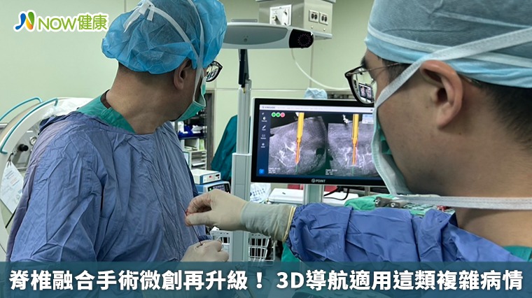 脊椎融合手術微創再升級! 3D導航適用這類複雜病情 脊椎融合手術微創再升級! 3D導航適用這類複雜病情