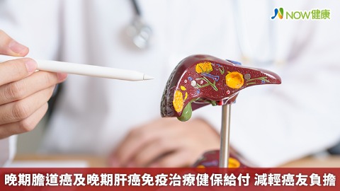 晚期膽道癌及晚期肝癌免疫治療健保給付 減輕癌友負擔