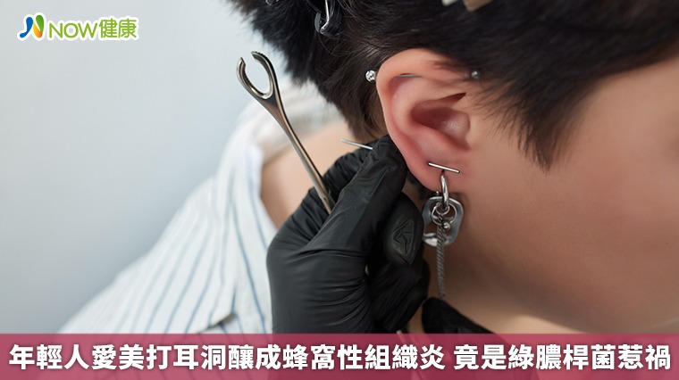 年輕人愛美打耳洞釀成蜂窩性組織炎 竟是綠膿桿菌惹禍 年輕人愛美打耳洞釀成蜂窩性組織炎 竟是綠膿桿菌惹禍