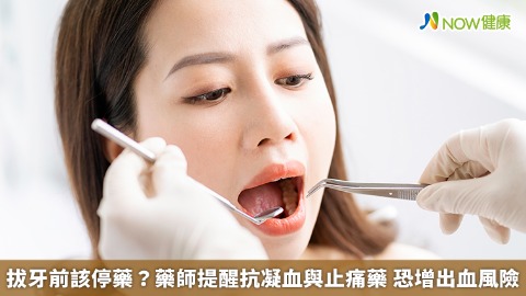 拔牙前該停藥？藥師提醒抗凝血與止痛藥 恐增出血風險