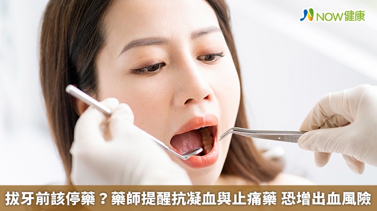 拔牙前該停藥?藥師提醒抗凝血與止痛藥 恐增出血風險 拔牙前該停藥?藥師提醒抗凝血與止痛藥 恐增出血風險