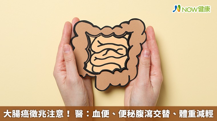 大腸癌徵兆注意! 醫:血便、便秘腹瀉交替、體重減輕 大腸癌徵兆注意! 醫:血便、便秘腹瀉交替、體重減輕