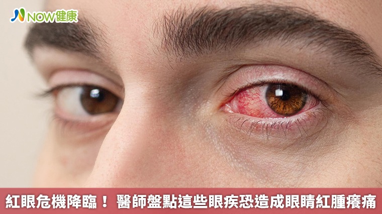 紅眼危機降臨! 醫師盤點這些眼疾恐造成眼睛紅腫癢痛 紅眼危機降臨! 醫師盤點這些眼疾恐造成眼睛紅腫癢痛