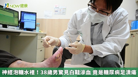 神經泡糖水裡！38歲男驚見白鞋滲血 竟是糖尿病足潰瘍 