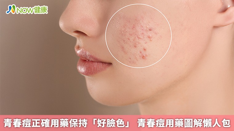 青春痘正確用藥保持「好臉色」 青春痘用藥圖解懶人包 青春痘正確用藥保持「好臉色」 青春痘用藥圖解懶人包
