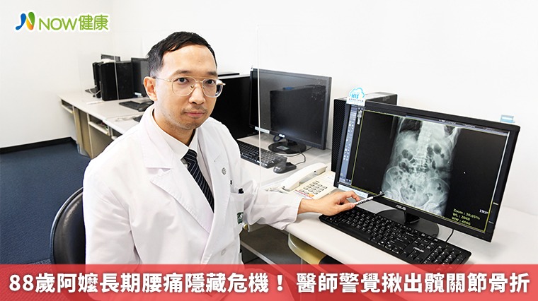 88歲阿嬤長期腰痛隱藏危機! 醫師警覺揪出髖關節骨折 88歲阿嬤長期腰痛隱藏危機! 醫師警覺揪出髖關節骨折