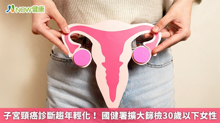 子宮頸癌診斷趨年輕化! 國健署擴大篩檢30歲以下女性 子宮頸癌診斷趨年輕化! 國健署擴大篩檢30歲以下女性
