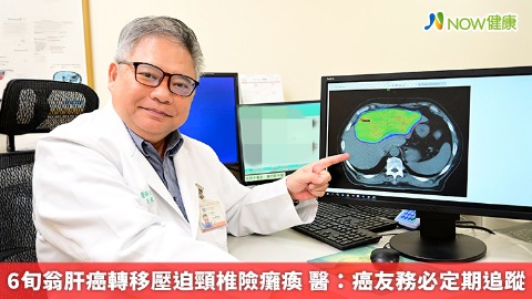 6旬翁肝癌轉移壓迫頸椎險癱瘓 醫：癌友務必定期追蹤 