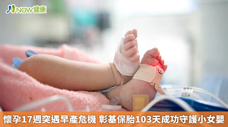 懷孕17週突遇早產危機 彰基保胎103天成功守護小女嬰 懷孕17週突遇早產危機 彰基保胎103天成功守護小女嬰