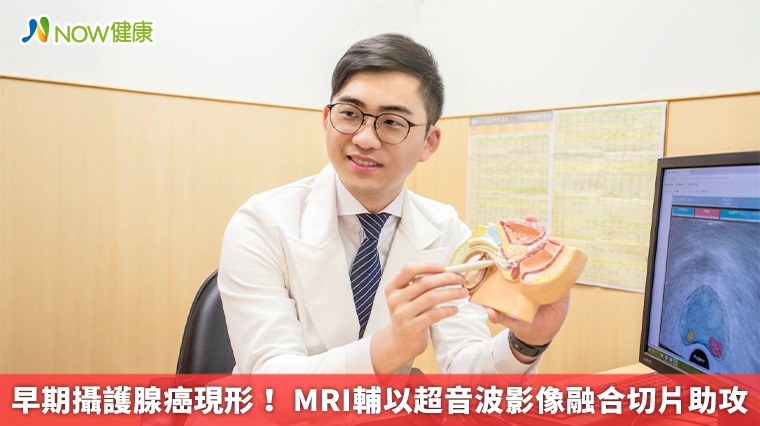 早期攝護腺癌現形! MRI輔以超音波影像融合切片助攻 早期攝護腺癌現形! MRI輔以超音波影像融合切片助攻