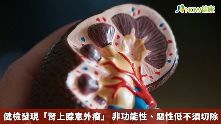 健檢發現「腎上腺意外瘤」 非功能性、惡性低不須切除 健檢發現「腎上腺意外瘤」 非功能性、惡性低不須切除