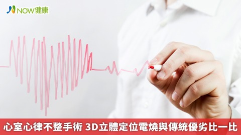 心室心律不整手術 3D立體定位電燒與傳統優劣比一比