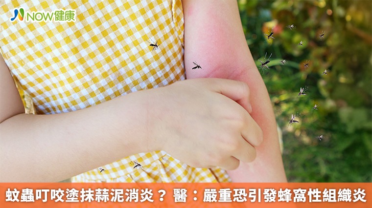 蚊蟲叮咬塗抹蒜泥消炎? 醫:嚴重恐引發蜂窩性組織炎 蚊蟲叮咬塗抹蒜泥消炎? 醫:嚴重恐引發蜂窩性組織炎