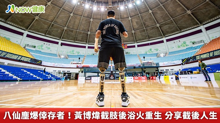 八仙塵爆倖存者!黃博煒截肢後浴火重生 分享截後人生 八仙塵爆倖存者!黃博煒截肢後浴火重生 分享截後人生