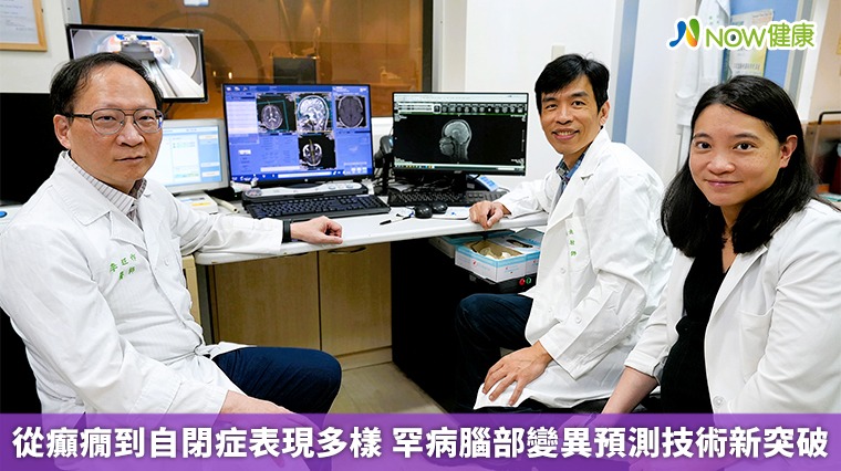 從癲癇到自閉症表現多樣 罕病腦部變異預測技術新突破 從癲癇到自閉症表現多樣 罕病腦部變異預測技術新突破