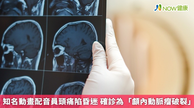 知名動畫配音員頭痛陷昏迷 確診為「顱內動脈瘤破裂」 知名動畫配音員頭痛陷昏迷 確診為「顱內動脈瘤破裂」