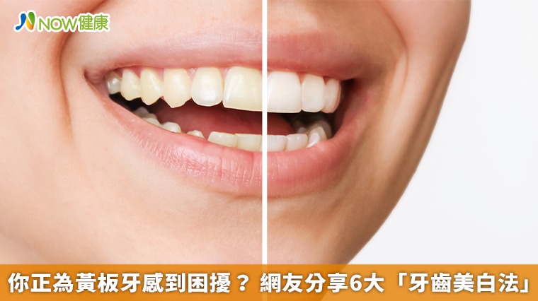 你正為黃板牙感到困擾? 網友分享6大「牙齒美白法」 你正為黃板牙感到困擾? 網友分享6大「牙齒美白法」