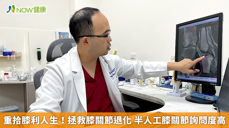 重拾膝利人生!拯救膝關節退化 半人工膝關節詢問度高 重拾膝利人生!拯救膝關節退化 半人工膝關節詢問度高