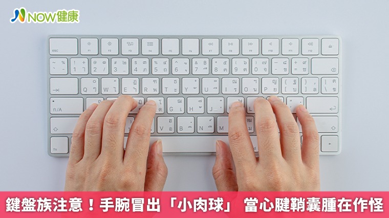 鍵盤族注意！手腕冒出「小肉球」 當心腱鞘囊腫在作怪