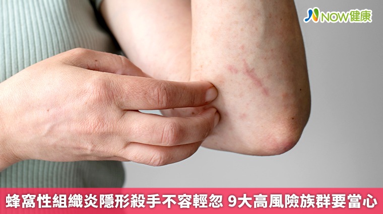 小傷口也要留意。