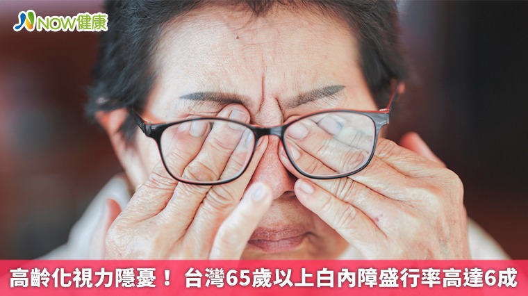 高齡化視力隱憂！ 台灣65歲以上白內障盛行率高達6成