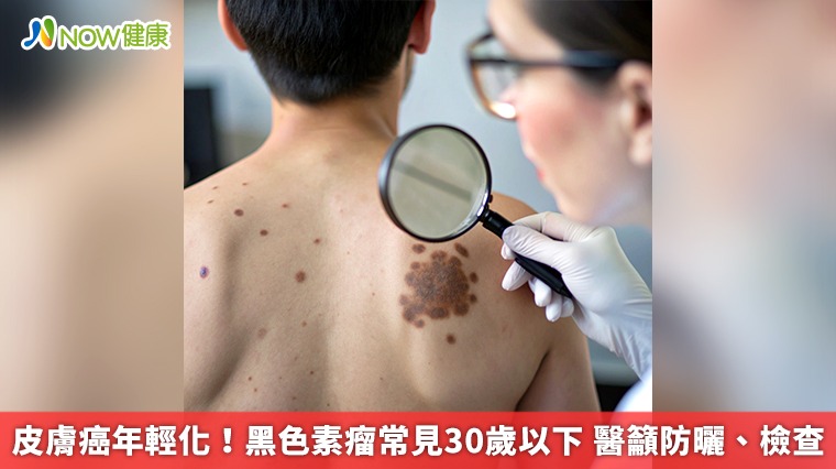 皮膚癌年輕化！黑色素瘤常見30歲以下 醫籲防曬、檢查