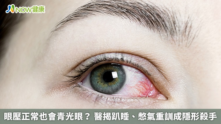 眼壓正常也會青光眼? 醫揭趴睡、憋氣重訓成隱形殺手 眼壓正常也會青光眼? 醫揭趴睡、憋氣重訓成隱形殺手