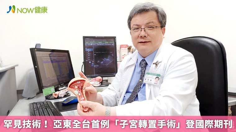  罕見技術！ 亞東全台首例「子宮轉置手術」登國際期刊