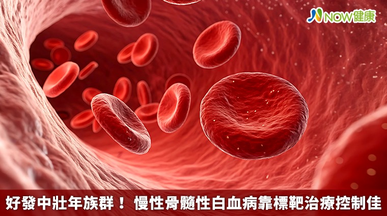 好發中壯年族群！ 慢性骨髓性白血病靠標靶治療控制佳