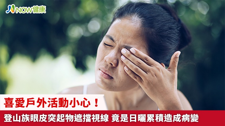 喜愛戶外活動小心！登山族眼皮突起物遮擋視線 竟是日曬累積造成病變
