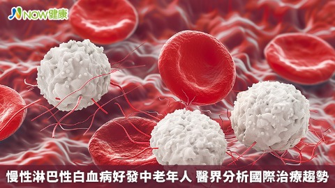 慢性淋巴性白血病好發中老年人 醫界分析國際治療趨勢