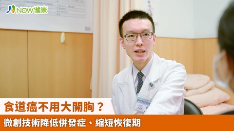 食道癌不用大開胸？ 微創技術降低併發症、縮短恢復期