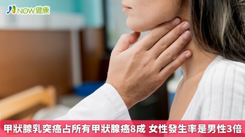 甲狀腺乳突癌占所有甲狀腺癌8成 女性發生率是男性3倍