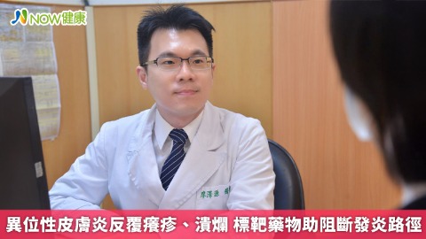 異位性皮膚炎反覆癢疹、潰爛 標靶藥物助阻斷發炎路徑