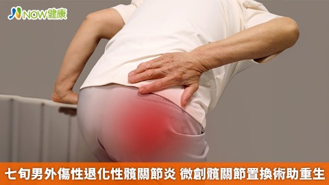七旬男外傷性退化性髖關節炎 微創髖關節置換術助重生