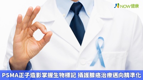 PSMA正子造影掌握生物標記 攝護腺癌治療邁向精準化