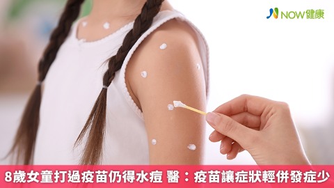8歲女童打過疫苗仍得水痘 醫：疫苗讓症狀輕併發症少