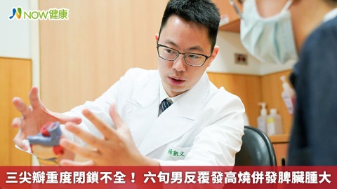 三尖瓣重度閉鎖不全！ 六旬男反覆發高燒併發脾臟腫大