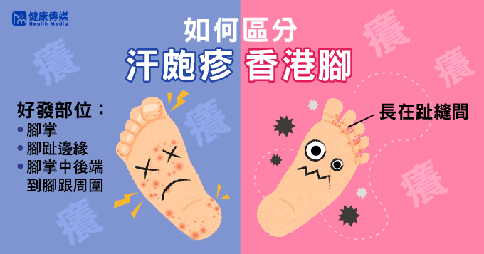 汗皰疹