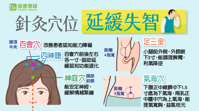 失智人口攀升 中醫輔助延緩大腦老化 臺北市立聯合醫院林森中醫昆明院區中醫科主治醫師張尚智建議,可針對這5大穴位進行針灸或按壓,可延緩失智症狀。(圖/健康傳媒製作)